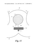 Topical devices and methods for assisting performance of surgical incision diagram and image