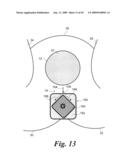 Topical devices and methods for assisting performance of surgical incision diagram and image