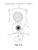 Topical devices and methods for assisting performance of surgical incision diagram and image