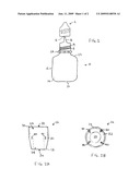 METHOD FOR PREVENTION AND TREATMENT OF REFLUX INJURY IN THE AERODIGESTIVE TRACT AND LARYNGOPHARYNX CAUSED BY PEPSIN diagram and image