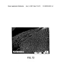 Eplerenone Drug Substance Having High Phase Purity diagram and image