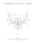 METHOD AND APPARATUS FOR PUBIC SLING INSERTION diagram and image