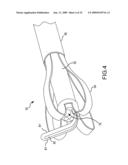 ENDOSCOPIC SYSTEM FOR ACCESSING CONSTRAINED SURGICAL SPACES diagram and image