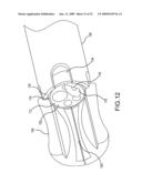 ENDOSCOPIC SYSTEM FOR ACCESSING CONSTRAINED SURGICAL SPACES diagram and image