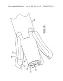 ENDOSCOPIC SYSTEM FOR ACCESSING CONSTRAINED SURGICAL SPACES diagram and image