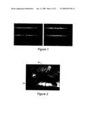 Portable Pulmonary Injury diagnostic Devices And Methods diagram and image