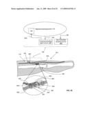 Implant system for chemical modulation of neural activity diagram and image