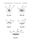 Ophthalmic fluid delivery system diagram and image