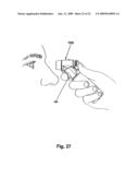 Ophthalmic fluid delivery system diagram and image