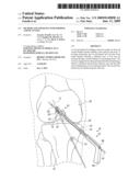 Method And Apparatus For Forming A Bone Tunnel diagram and image