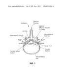 TISSUE MODIFICATION DEVICES diagram and image