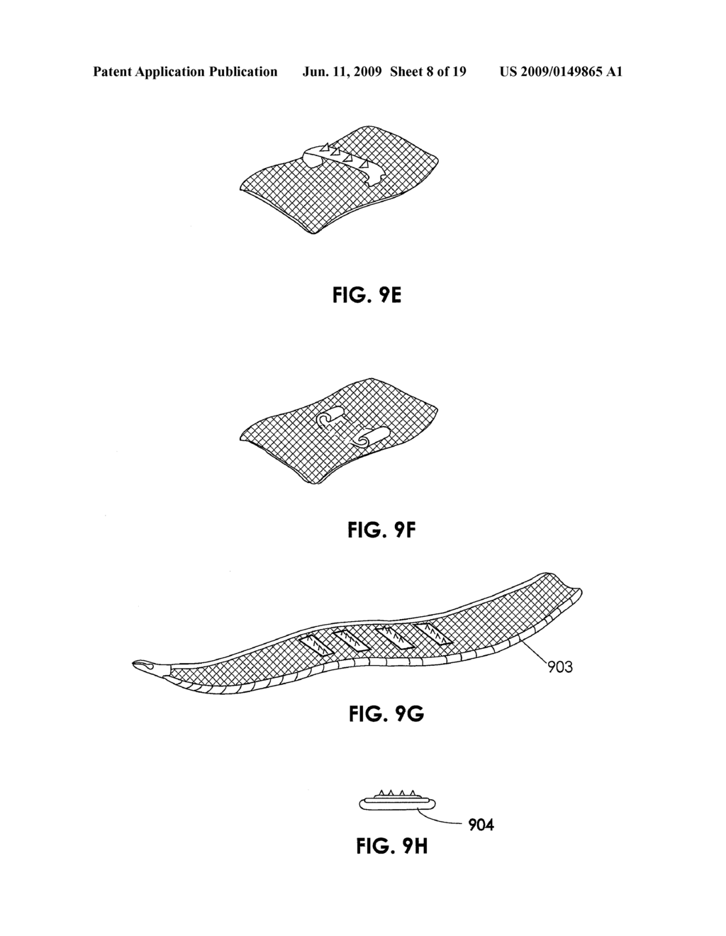 TISSUE MODIFICATION DEVICES - diagram, schematic, and image 09