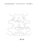 TISSUE MODIFICATION DEVICES diagram and image