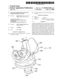 KNEE JOINT PROSTHESIS SYSTEM AND METHOD FOR IMPLANTATION diagram and image