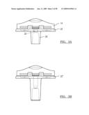 KNEE JOINT PROSTHESIS SYSTEM AND METHOD FOR IMPLANTATION diagram and image