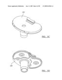 KNEE JOINT PROSTHESIS SYSTEM AND METHOD FOR IMPLANTATION diagram and image