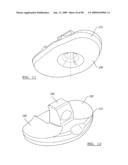 KNEE JOINT PROSTHESIS SYSTEM AND METHOD FOR IMPLANTATION diagram and image