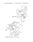 KNEE JOINT PROSTHESIS SYSTEM AND METHOD FOR IMPLANTATION diagram and image