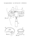 KNEE JOINT PROSTHESIS SYSTEM AND METHOD FOR IMPLANTATION diagram and image