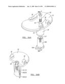 KNEE JOINT PROSTHESIS SYSTEM AND METHOD FOR IMPLANTATION diagram and image