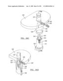 KNEE JOINT PROSTHESIS SYSTEM AND METHOD FOR IMPLANTATION diagram and image