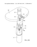 KNEE JOINT PROSTHESIS SYSTEM AND METHOD FOR IMPLANTATION diagram and image