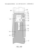 KNEE JOINT PROSTHESIS SYSTEM AND METHOD FOR IMPLANTATION diagram and image