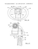 KNEE JOINT PROSTHESIS SYSTEM AND METHOD FOR IMPLANTATION diagram and image