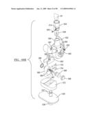 KNEE JOINT PROSTHESIS SYSTEM AND METHOD FOR IMPLANTATION diagram and image