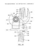 KNEE JOINT PROSTHESIS SYSTEM AND METHOD FOR IMPLANTATION diagram and image