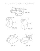 KNEE JOINT PROSTHESIS SYSTEM AND METHOD FOR IMPLANTATION diagram and image