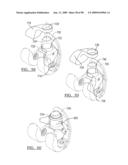 KNEE JOINT PROSTHESIS SYSTEM AND METHOD FOR IMPLANTATION diagram and image