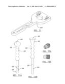 KNEE JOINT PROSTHESIS SYSTEM AND METHOD FOR IMPLANTATION diagram and image