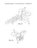 KNEE JOINT PROSTHESIS SYSTEM AND METHOD FOR IMPLANTATION diagram and image