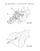 KNEE JOINT PROSTHESIS SYSTEM AND METHOD FOR IMPLANTATION diagram and image