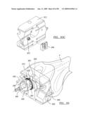 KNEE JOINT PROSTHESIS SYSTEM AND METHOD FOR IMPLANTATION diagram and image