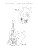 KNEE JOINT PROSTHESIS SYSTEM AND METHOD FOR IMPLANTATION diagram and image