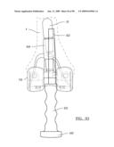 KNEE JOINT PROSTHESIS SYSTEM AND METHOD FOR IMPLANTATION diagram and image