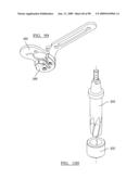 KNEE JOINT PROSTHESIS SYSTEM AND METHOD FOR IMPLANTATION diagram and image