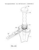 KNEE JOINT PROSTHESIS SYSTEM AND METHOD FOR IMPLANTATION diagram and image