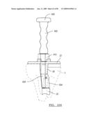 KNEE JOINT PROSTHESIS SYSTEM AND METHOD FOR IMPLANTATION diagram and image