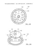 KNEE JOINT PROSTHESIS SYSTEM AND METHOD FOR IMPLANTATION diagram and image