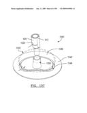 KNEE JOINT PROSTHESIS SYSTEM AND METHOD FOR IMPLANTATION diagram and image