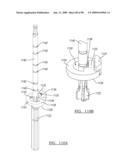 KNEE JOINT PROSTHESIS SYSTEM AND METHOD FOR IMPLANTATION diagram and image