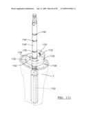 KNEE JOINT PROSTHESIS SYSTEM AND METHOD FOR IMPLANTATION diagram and image