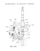 KNEE JOINT PROSTHESIS SYSTEM AND METHOD FOR IMPLANTATION diagram and image