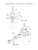 KNEE JOINT PROSTHESIS SYSTEM AND METHOD FOR IMPLANTATION diagram and image