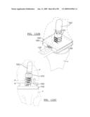 KNEE JOINT PROSTHESIS SYSTEM AND METHOD FOR IMPLANTATION diagram and image