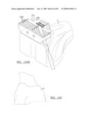 KNEE JOINT PROSTHESIS SYSTEM AND METHOD FOR IMPLANTATION diagram and image