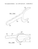 KNEE JOINT PROSTHESIS SYSTEM AND METHOD FOR IMPLANTATION diagram and image